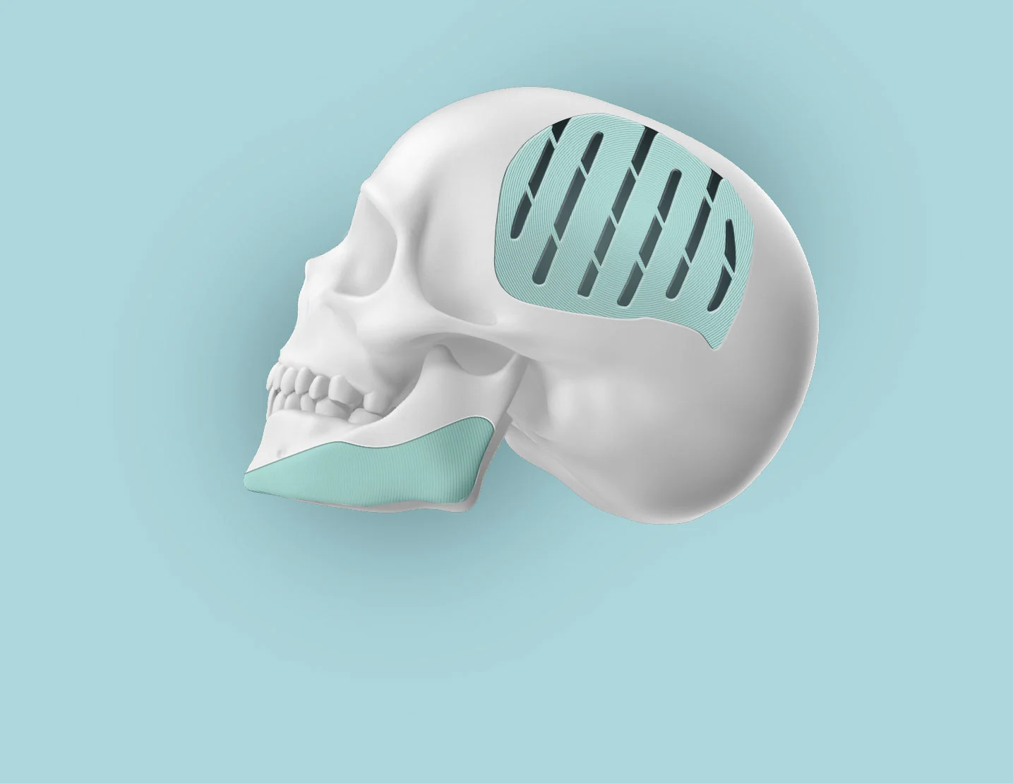 hero image presenting skull implant